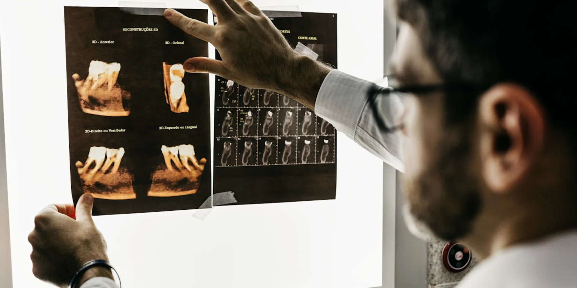 AI-Assisted Diagnostics: The Future of Dental Imaging
